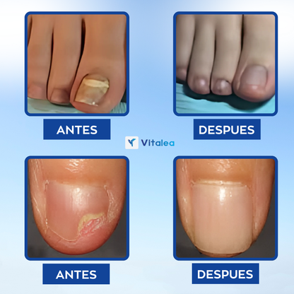 Vitalea NailPro Light™: Salud y belleza al instante para tus uñas