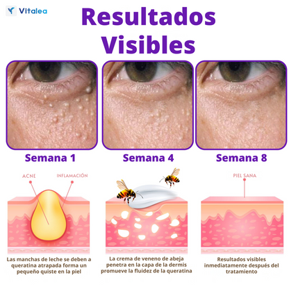 Vitalea HoneyVive🧴 Crema facial Anti-Edad de Colágeno